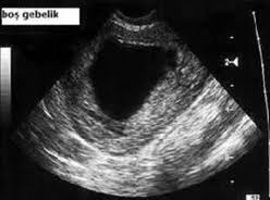 bos gebelik2-24e.jpg